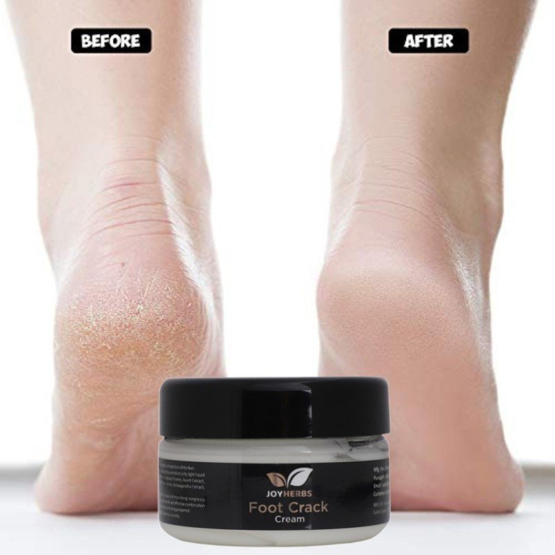 Joyherbs Foot Repair Cream For Cracked Heels & Feet Whitening, Cleansing(50 G)
